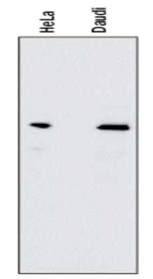 Western Blot: RelA/NFkB p65 Antibody (112A1021) - Azide Free [NBP2-27416] - Lysates of HeLa human cervical epithelial carcinoma cell line and Daudi human Burkitt's lymphoma cell line. PVDF membrane was probed with 1 ug/mL mouse anti-RelA/NFkB p65 monoclonal (NB100-56712, Novus Biologicals), followed by 1:2000 dilution of the appropriate HRP-conjugated secondary antibody, donkey anti-mouse IgG (HAF018). Image using the standard format of this product.