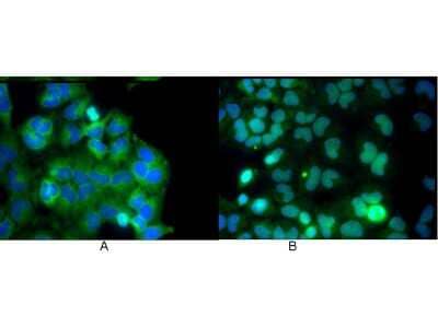 Immunocytochemistry/Immunofluorescence: RelA/NFkB p65 Antibody (27F9.G4) [NBP1-77815] - Used at a dilution of 1:5000. Hela cells were grown to sub-confluent on 18 mm2 glass coverslips #1.5. Cells were either unstimulated (A), or stimulated (B) with 50 ng/ml of TNF alpha for 30 min prior fixation. Cells were then fixed in methanol and blocked with 10% normal goat serum (NGS), in PBS, and TritonX 0.2% (Tx) and incubated for 1 hr at RT with primary ab, counterstained with DAPI and washed in PBS/NGS/Tx. Cells were incubated for 1 hr at RT with Atto 425 conjugated anti mouse secondary antibody for STED CW imaging.