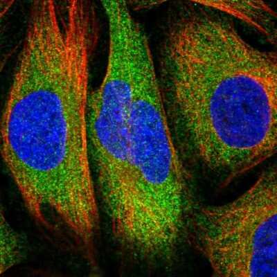 Immunocytochemistry/Immunofluorescence: RelA/NFkB p65 Antibody [NBP2-56067] - Staining of human cell line U-2 OS shows localization to cytosol. Antibody staining is shown in green.