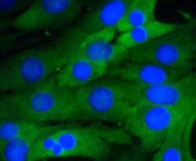 Immunocytochemistry/Immunofluorescence: RelA/NFkB p65 NLS Antibody (SZ10-04) [NBP2-67352] - Staining NF-kB p65 in NIH/3T3 cells (green). The nuclear counter stain is DAPI (blue). Cells were fixed in paraformaldehyde, permeabilised with 0.25% Triton X100/PBS.