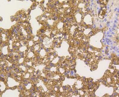 Immunohistochemistry-Paraffin: RelA/NFkB p65 NLS Antibody (SZ10-04) [NBP2-67352] - Analysis of paraffin-embedded mouse lung tissue using anti-NF-kB p65 antibody. Counter stained with hematoxylin.