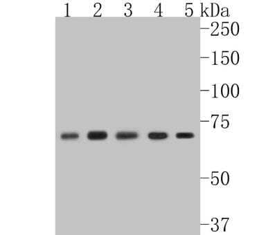 Western Blot: RelA/NFkB p65 NLS Antibody (SZ10-04) [NBP2-67352] - Analysis of NF-kB p65 on different lysates. Proteins were transferred to a PVDF membrane and blocked with 5% BSA in PBS for 1 hour at room temperature. The primary antibody (1/500) was used in 5% BSA at room temperature for 2 hours. Goat Anti-Rabbit IgG - HRP Secondary Antibody at 1:5,000 dilution was used for 1 hour at room temperature. Positive control: Lane 1: Jurkat cell lysateLane 2: K562 cell lysateLane 1: THP-1 cell lysateLane 1: MCF-7 cell lysateLane 2: Hela cell lysate