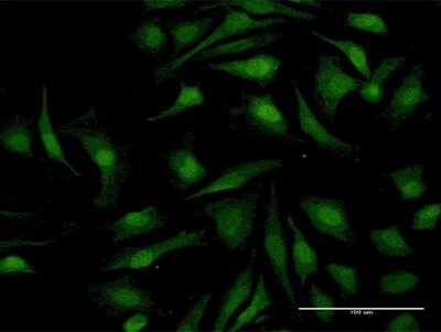 Immunocytochemistry/Immunofluorescence: RelB Antibody [H00005971-B01P] - Analysis of purified antibody to RELB on HeLa cell. (antibody concentration 10 ug/ml)