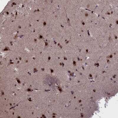 Immunohistochemistry-Paraffin: RelB Antibody [NBP2-34064] - Staining of human cerebral cortex shows strong nuclear positivity in neuronal cells.