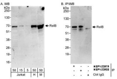 Western Blot: RelB Antibody [NBP1-22980] - Whole cell lysate from Jurkat, HeLa and mouse NIH3T3 cells. RelB was also immunoprecipitated by rabbit anti-RelB antibody NBP1-22979.