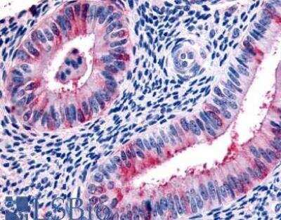 Immunohistochemistry-Paraffin: Relaxin R2/LGR8 Antibody [NLS4751] - Analysis of anti-RXFP2 / LGR8 antibody with human uterus.