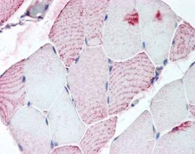 Immunohistochemistry-Paraffin: Relaxin R2/LGR8 Antibody [NLS4752] - Analysis of anti-RXFP2 antibody with human skeletal muscle.