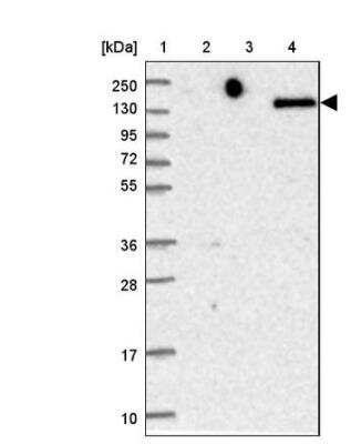 Western Blot: Renal Cell Carcinoma (gp200) Antibody [NBP2-48926] - Lane 1: Marker  [kDa] 250, 130, 95, 72, 55, 36, 28, 17, 10.  Lane 2: Human cell line RT-4, Lane 3: Human cell line U-251MG sp, Lane 4: Human plasma (igG/HSa depleted).