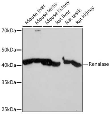 Western Blot: Renalase Antibody (9A5T7) [NBP3-15922] - Western blot analysis of extracts of various cell lines, using Renalase Rabbit mAb (NBP3-15922) at 1:1000 dilution. Secondary antibody: HRP Goat Anti-Rabbit IgG (H+L) at 1:10000 dilution. Lysates/proteins: 25ug per lane. Blocking buffer: 3% nonfat dry milk in TBST. Detection: ECL Basic Kit. Exposure time: 10s.