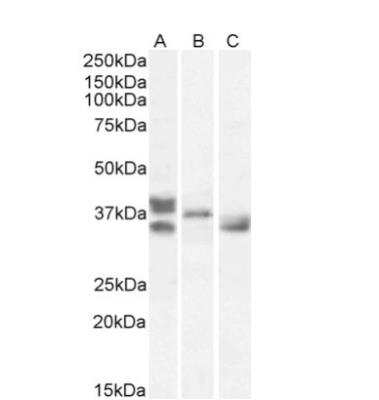Western Blot: Renalase Antibody [NB100-1493] -  Staining of Human Heart (A), Mouse Heart (B), Rat Heart (C) lysates (35ug protein in RIPA buffer). Detected by chemiluminescence.
