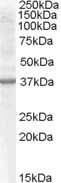 Western Blot: Renalase Antibody [NB100-93435] - (0.5ug/ml) staining of Rat Kidney lysate (35ug protein in RIPA buffer). Primary incubation was 1 hour. Detected by chemiluminescence.