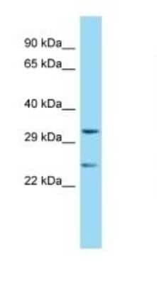 Western Blot: Renalase Antibody [NBP1-98475] - Titration: 1.0 ug/ml Positive Control: Mouse Heart.