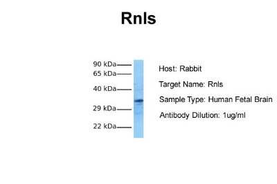 Western Blot: Renalase Antibody [NBP1-98475] - Sample Tissue: Human Fetal Brain Antibody Dilution: 1.0 ug/ml