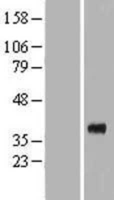 Western Blot: Renalase Overexpression Lysate (Adult Normal) [NBP2-06817] Left-Empty vector transfected control cell lysate (HEK293 cell lysate); Right -Over-expression Lysate for Renalase.