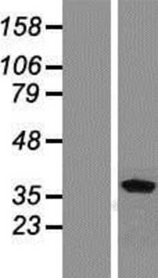Western Blot: Renalase Overexpression Lysate (Adult Normal) [NBP2-10608] Left-Empty vector transfected control cell lysate (HEK293 cell lysate); Right -Over-expression Lysate for Renalase.