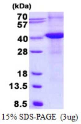 SDS-PAGE Recombinant Human Renalase His Protein