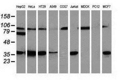 Western Blot: Replication Termination Factor 2 Antibody (OTI1E8) - Azide and BSA Free [NBP2-71934] - Analysis of extracts (35ug) from 9 different cell lines by using anti-C20orf43 monoclonal antibody.