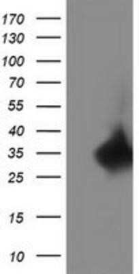 Western Blot: Replication Termination Factor 2 Antibody (OTI1E8) - Azide and BSA Free [NBP2-71934] - HEK293T cells were transfected with the pCMV6-ENTRY control (Left lane) or pCMV6-ENTRY C20orf43 (Right lane) cDNA for 48 hrs and lysed. Equivalent amounts of cell lysates (5 ug per lane) were separated by SDS-PAGE and immunoblotted with anti-C20orf43.