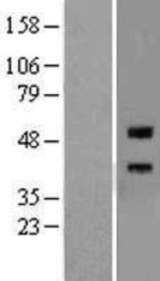 Western Blot RGM-A Overexpression Lysate