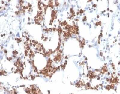 Immunohistochemistry-Paraffin: Resistin Antibody (RETN/3331) [NBP3-08250] - Formalin-fixed, paraffin-embedded human bone marrow stained with Resistin Mouse Monoclonal Antibody (RETN/3331).