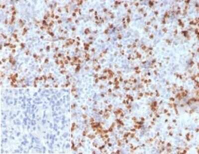 Immunohistochemistry-Paraffin: Resistin Antibody (RETN/3331) [NBP3-08250] - Formalin-fixed, paraffin-embedded human spleen stained with Resistin Mouse Monoclonal Antibody (RETN/3331) Inset: PBS used instead of primary antibody as negative control