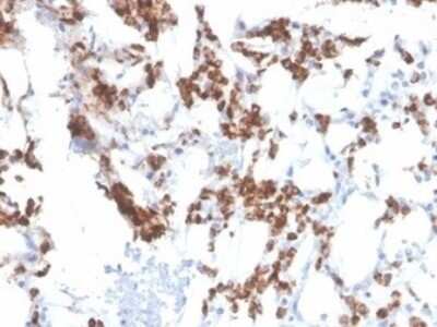 Immunohistochemistry-Paraffin: Resistin Antibody (RETN/3331) [NBP3-08250] - Formalin-fixed, paraffin-embedded human bone marrow stained with Resistin Mouse Monoclonal Antibody (RETN/3331).