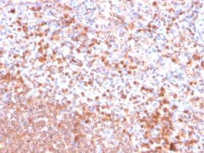 Immunohistochemistry-Paraffin: Resistin Antibody (RETN/4326) [NBP3-08258] - Formalin-fixed, paraffin-embedded human spleen stained with Resistin Mouse Monoclonal Antibody (RETN/4326).