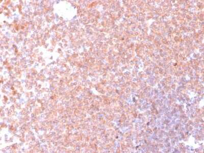 Immunohistochemistry-Paraffin: Resistin Antibody (RETN/4326) [NBP3-08258] - Formalin-fixed, paraffin-embedded human spleen stained with Resistin Mouse Monoclonal Antibody (RETN/4326).