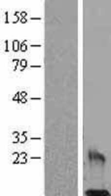 Western Blot Resistin Overexpression Lysate