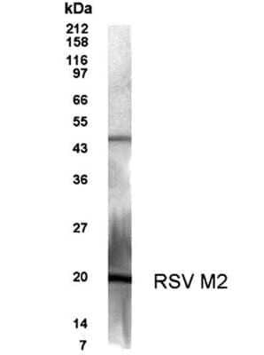 Western Blot Respiratory Syncytial Virus M2-1 Protein Antibody - BSA Free