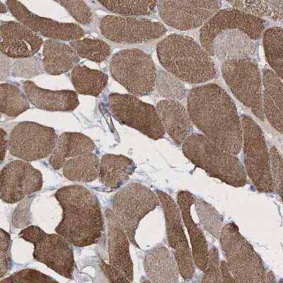 Immunohistochemistry: Reticulon 2 Antibody [NBP2-38225] - Staining of human skeletal muscle shows moderate cytoplasmic positivity in myocytes.