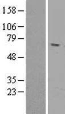 Western Blot: Reticulon 2 Overexpression Lysate (Adult Normal) [NBL1-15611] Left-Empty vector transfected control cell lysate (HEK293 cell lysate); Right -Over-expression Lysate for Reticulon 2.