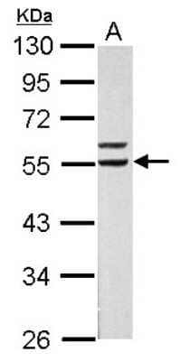 Western Blot: Retinoid X Receptor alpha Antibody [NBP2-20130] - Sample (30 ug of whole cell lysate) A: HepG2 10% SDS PAGE gel, diluted at 1:5000.