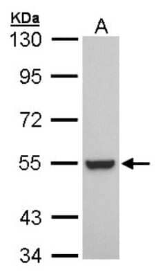 Western Blot: Retinoid X Receptor beta Antibody [NBP1-30897] - Sample (30 ug of whole cell lysate) A: A431 7. 5% SDS PAGE; antibody diluted at 1:1000.