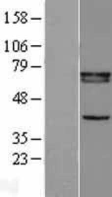 Western Blot RXR beta/NR2B2 Overexpression Lysate