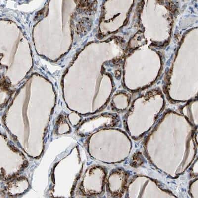Immunohistochemistry-Paraffin: Retinol Saturase Antibody [NBP1-92325] - Staining of human thyroid gland shows strong cytoplasmic positivity with granular pattern in glandular cells.