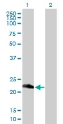 Western Blot: Retinol Saturase Antibody [H00054884-B01P] - Analysis of RetSat expression in transfected 293T cell line by RetSat polyclonal antibody.  Lane 1: RetSat transfected lysate(22.55 KDa). Lane 2: Non-transfected lysate.