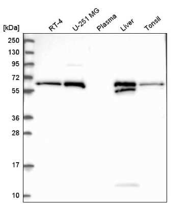 Western Blot: Retinol Saturase Antibody [NBP2-58103] - Analysis in human cell line RT-4, human cell line U-251 MG, human plasma, human liver tissue and human tonsil tissue.