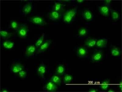 Immunocytochemistry/Immunofluorescence: Rev-erb beta/NR1D2 Antibody (1G2) [H00009975-M01] - Analysis of monoclonal antibody to NR1D2 on HeLa cell. Antibody concentration 10 ug/ml.