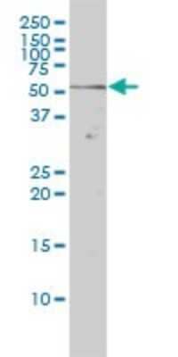 Western Blot: Rev-erb beta/NR1D2 Antibody (1G2) [H00009975-M01] - NR1D2 monoclonal antibody (M01), clone 1G2 Analysis of NR1D2 expression in Hela.