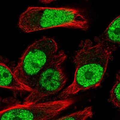 Immunocytochemistry/Immunofluorescence: Rev-erb beta/NR1D2 Antibody [NBP2-56141] - Staining of human cell line PC-3 shows localization to nucleoplasm.