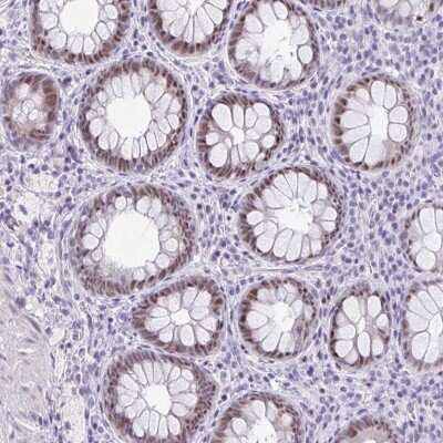 Immunohistochemistry: Rev-erb beta/NR1D2 Antibody [NBP2-47306] - Staining of human rectum shows moderate nuclear positivity in glandular cells.