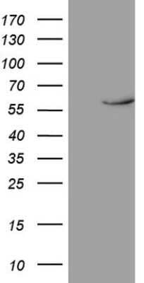 Western Blot: Rev-erb beta/NR1D2 Antibody (OTI5E10) - Azide and BSA Free [NBP2-73854] - Analysis of HEK293T cells were transfected with the pCMV6-ENTRY control (Left lane) or pCMV6-ENTRY NR1D2.