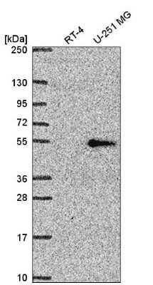 Western Blot: Rev-erb beta/NR1D2 Antibody [NBP2-56141] - Analysis in human cell line RT-4 and human cell line U-251 MG.