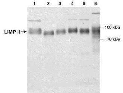 Western Blot: Reverse Cholesterol Transport Antibody Pack 3vials [NBP1-78954] -  Detection of LIMP II (~85 kDa) using NB400-129, in Lane 1: Rat cardiac fibroblasts (RCF), 3T3 mouse fibroblasts (2), canine lung lysate (3), RCF treated with angiotensin II (4), and H2O2 (5), HEPG2 human liver lysate (6).
