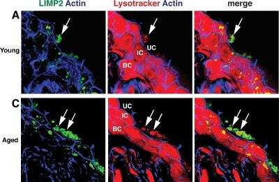 Immunohistochemistry: Reverse Cholesterol Transport Antibody Pack [NBP1-78954] - Lysotracker Red accumulates in endolysosomes.Immunofluorescence of young (A) and aged (C) urothelium incubated with Lysotracker Red (red) and co-stained with antibodies to LIMP2 (green structures) and phalloidin (blue), which labels the cortical actin cytoskeleton. Large, Lysotracker Red-positive endolysosomes are marked with white arrows. Underlying intermediate (IC) and basal cells (BC) show non-specific cytoplasmic Lysotracker Red staining that did not appear in umbrella cells (UC). Image collected and cropped by CiteAb from the following publication (//dx.plos.org/10.1371/journal.pone.0198817), licensed under a CC-BY license. LIMPII/SR-B2 Antibody [NB400-129]