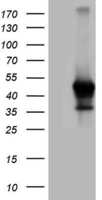 Western Blot: Rex-1/ZFP42 Antibody (3H9) [NBP2-46406] - Analysis of HEK293T cells were transfected with the pCMV6-ENTRY control (Left lane) or pCMV6-ENTRY ZFP42.