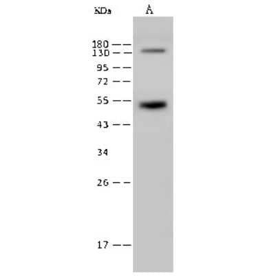 Western Blot: Rex-1/ZFP42 Antibody [NBP2-99539] - Anti-Rex-1/ZFP42 rabbit polyclonal antibody at 1:500 dilution. Lane A: Mouse brain tissue lysate Whole Cell Lysate Lysates/proteins at 30 ug per lane. Secondary Goat Anti-Rabbit IgG (H+L)/HRP at 1/10000 dilution. Developed using the ECL technique. Performed under reducing conditions. Predicted band size: 35kDa