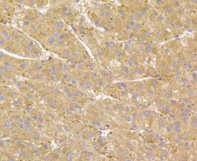 Immunohistochemistry-Paraffin: Rheb Antibody (JG37-12) [NBP2-75646] - Analysis of paraffin-embedded human liver tissue using anti-RHEB antibody. Counter stained with hematoxylin.