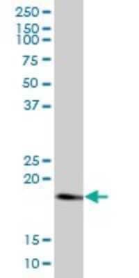 Western Blot: Rheb Antibody [H00006009-B01P] - Analysis of RHEB expression in A-431.